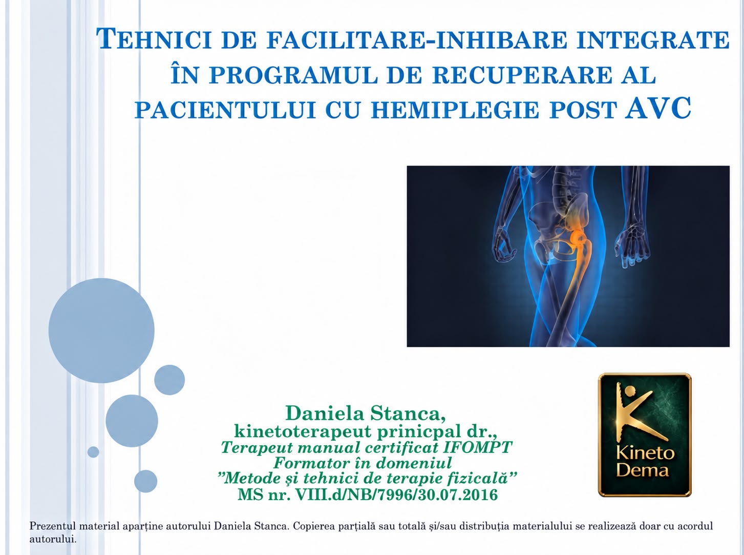 Managementul tendinopatiei gluteilor/Sindromului dureros al marelui trohanter